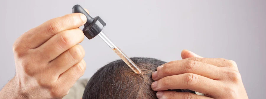 Minoxidil in Australia: How It Works for Hair Loss and Beard Growth